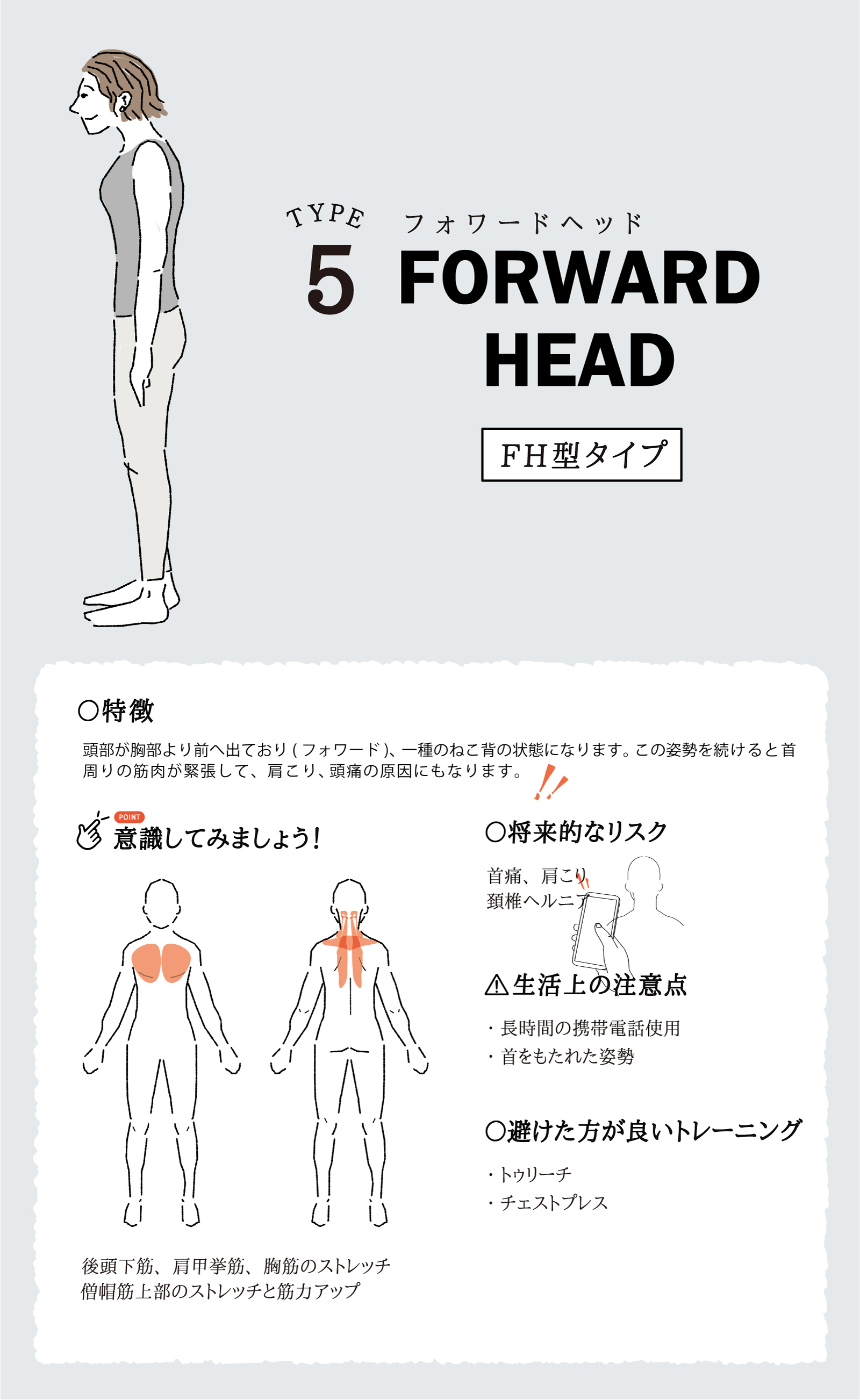 フォワードヘッド