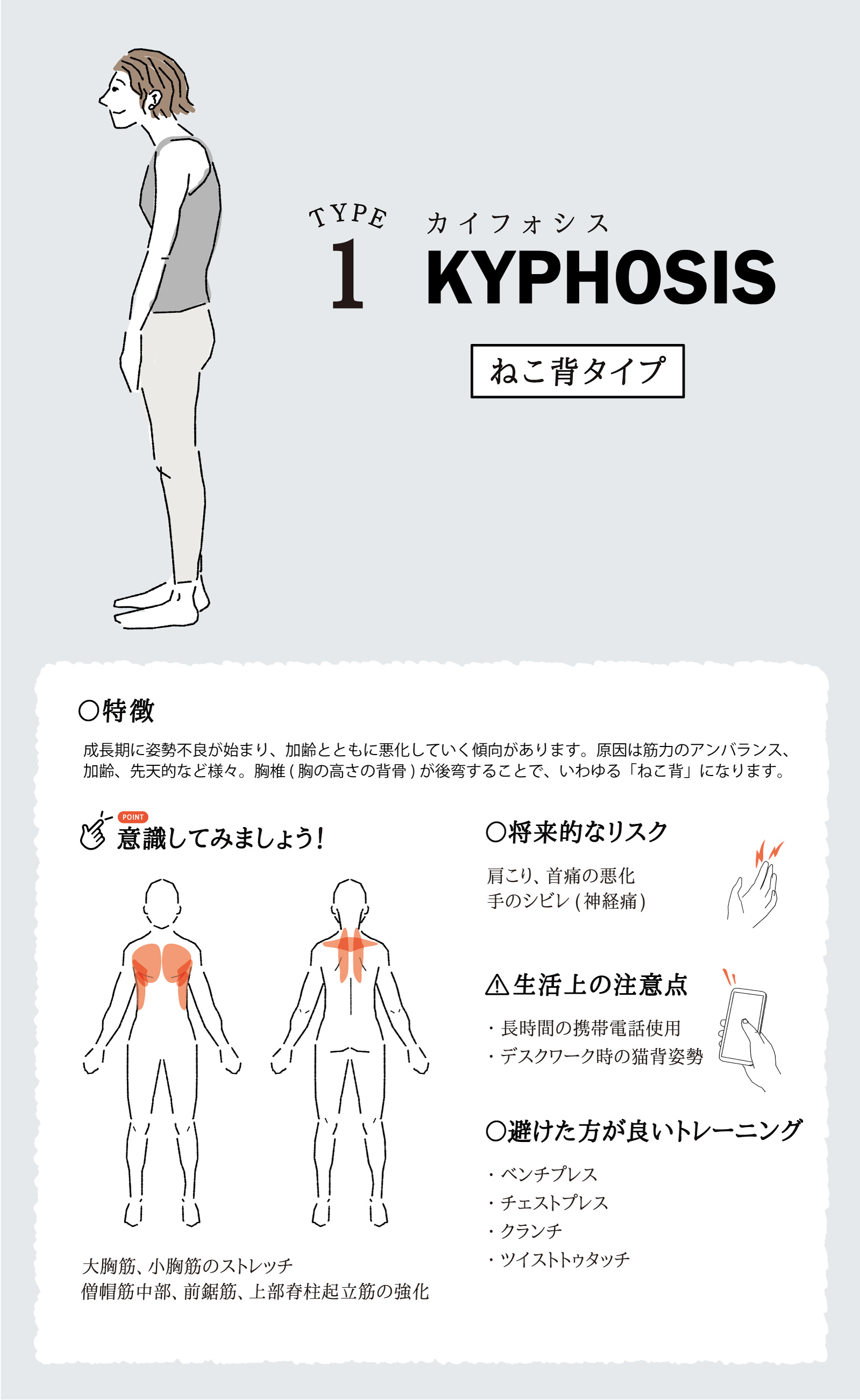 カイフォシス