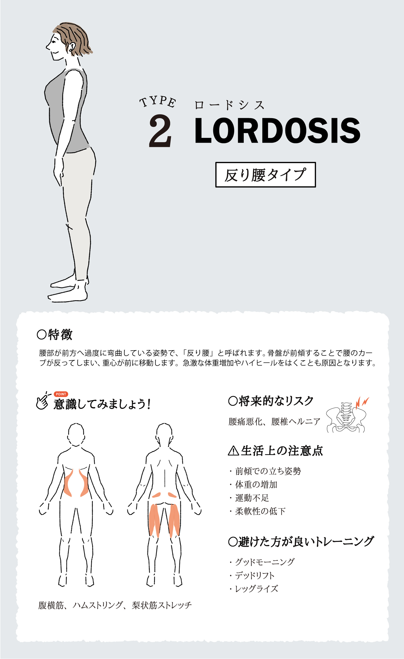 ロードシス